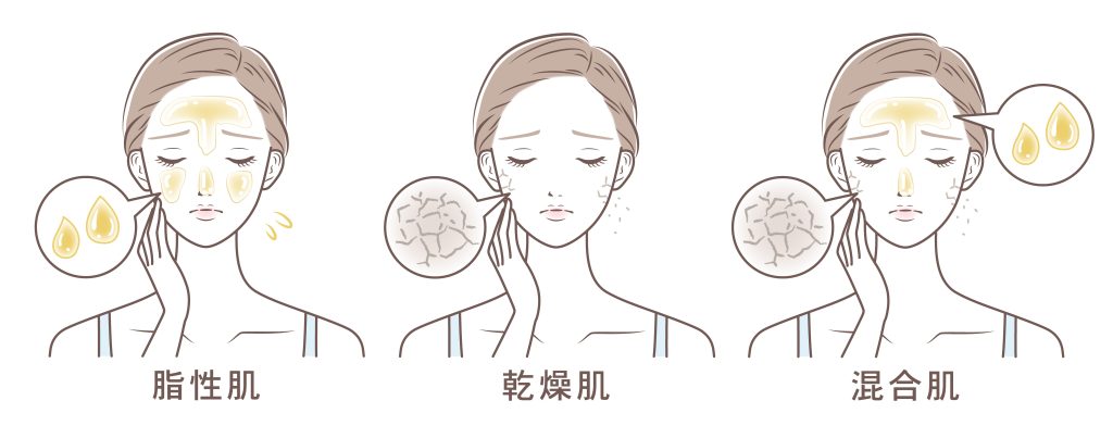 脂性肌とほかの肌質との違い